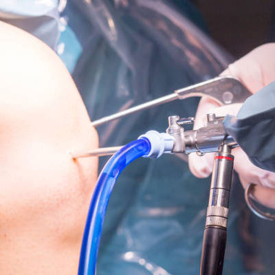 arthroscopy in Prakasham