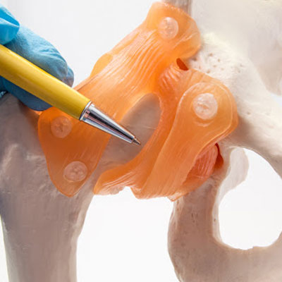 hip replacement hospitals in Ongole